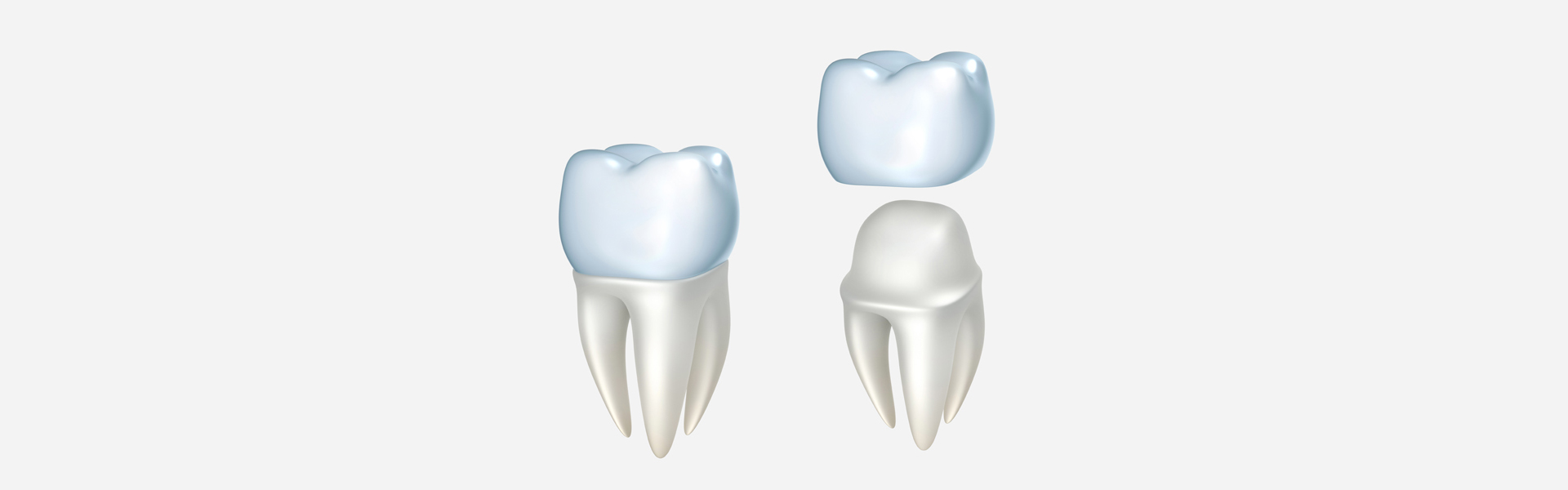 Dental Crown in Bella Vista, AR