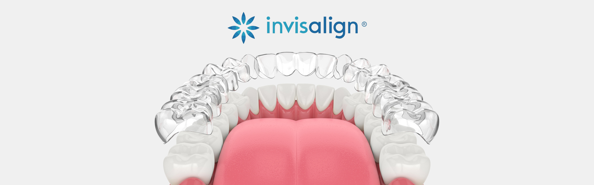 Invisalign in Bella Vista, AR