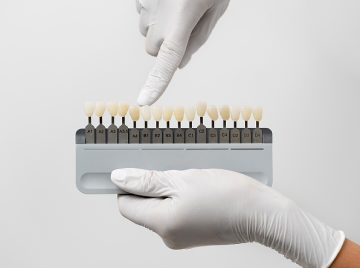 Dental Veneers Explained: Materials, Process & Results